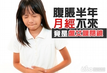 腹脹半年月經不來 竟是處女膜閉鎖