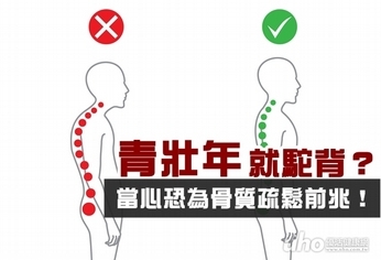 青壯年就駝背?骨質疏鬆前兆!