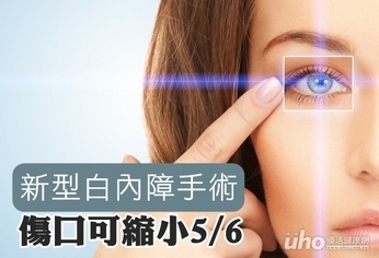 新型白內障手術 傷口可縮小5/6