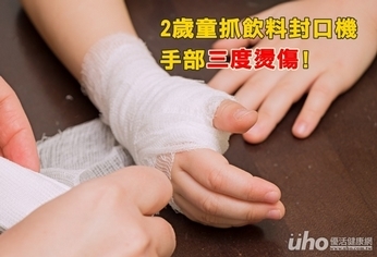 2歲童抓飲料封口機 致手部三度燙傷