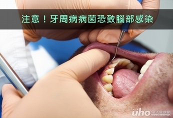 注意!牙周病病菌恐致腦部感染