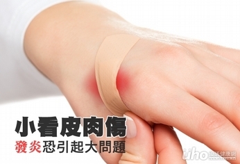 小看皮肉傷 發炎恐引起大問題