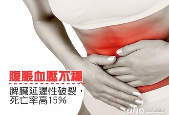 腹脹血壓不穩 脾臟延遲性破裂死亡率高15%