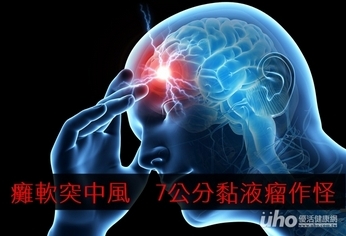 48歲男癱軟突中風 7公分黏液瘤作怪