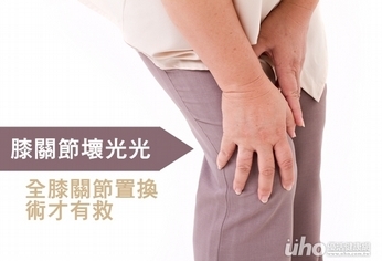 膝關節壞光光 全膝關節置換術才有救