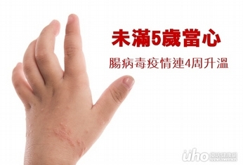 未滿5歲當心 腸病毒疫情連4周升溫