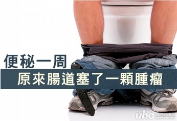 便秘一周 原來腸道塞了一顆腫瘤