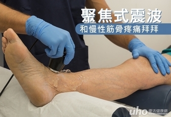 聚焦式震波 和慢性筋骨疼痛拜拜