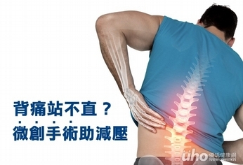 背痛站不直?微創手術助減壓