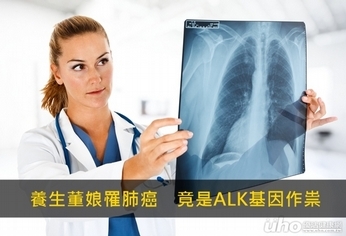 養生董娘罹肺癌 竟是ALK基因作祟