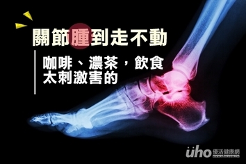 關節紅腫走不動 咖啡濃茶喝太多害的