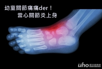 幼童關節痛痛der!當心關節炎上身