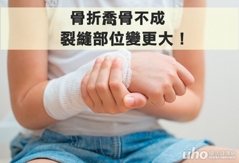 骨折喬骨不成 裂縫部位變更大!