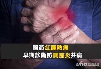 關節紅腫晨僵 早期診斷防關節炎共病