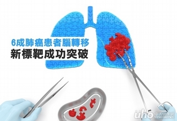 6成肺癌患者腦轉移 新標靶成功突破