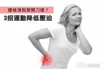 腰椎滑脫要開刀嗎?3招運動減壓迫