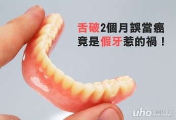 舌破2個月誤當癌 竟是假牙惹的禍!