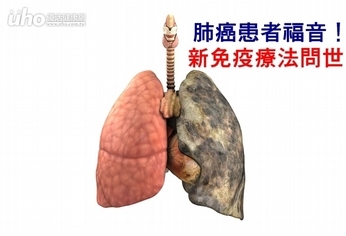 肺癌患者福音! 新免疫療法問世