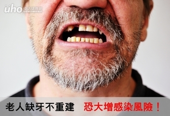 老人缺牙不重建 恐大增感染風險!