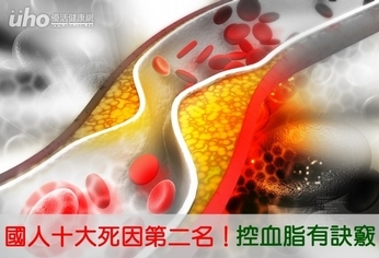 國人十大死因第二名!控血脂有訣竅