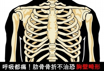 呼吸都痛!肋骨骨折不治恐胸壁畸形