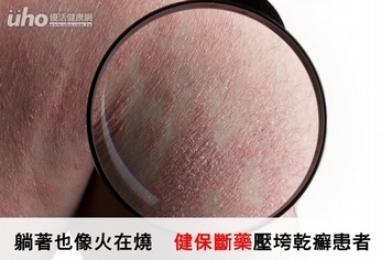 躺著也像火在燒 健保斷藥壓垮乾癬患者