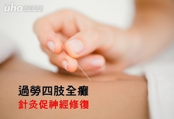 過勞四肢全癱 針灸促神經修復