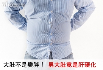 大肚不是變胖!男大肚竟是肝硬化