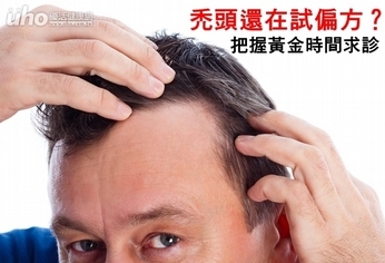 禿頭還在試偏方?把握黃金時間求診