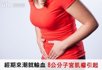經期來潮就輸血 8公分子宮肌瘤引起