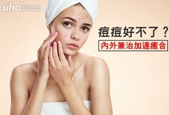 痘痘好不了?醫:內外兼治加速癒合