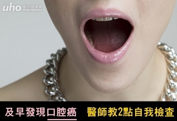 及早發現口腔癌 醫師教2點自我檢查