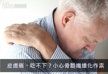 皮膚癢、吃不下?小心骨髓纖維化作祟