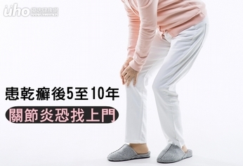 患乾癬後5至10年 關節炎恐找上門