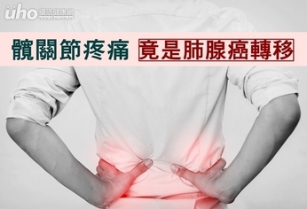 髖關節疼痛 竟是肺腺癌轉移!