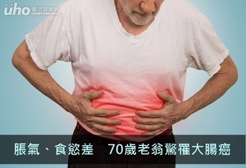 脹氣、食慾差 70歲老翁驚罹大腸癌
