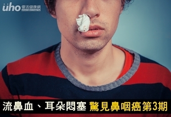 流鼻血、耳朵悶塞 驚見鼻咽癌第3期