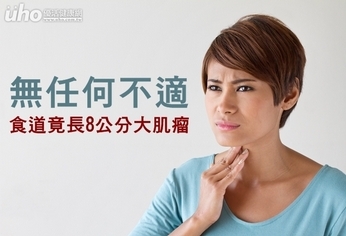 無任何不適 食道竟長8公分大肌瘤