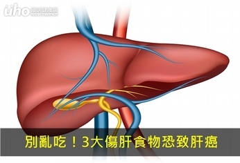 別亂吃!3大傷肝食物恐致肝癌