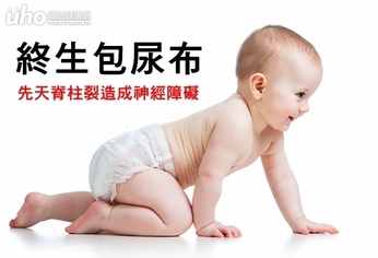終生包尿布 先天脊柱裂造成神經障礙