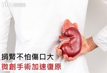 捐腎不怕傷口大 微創手術加速復原
