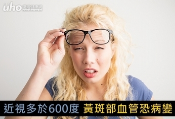 近視多於600度 黃斑部血管恐病變