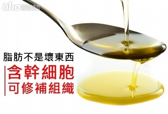 脂肪不是壞東西!含幹細胞可修補組織