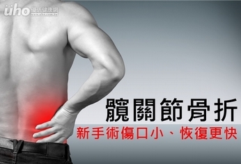 髖關節骨折 新手術傷口小、恢復更快