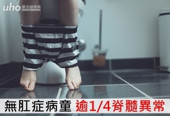 無肛症病童 逾1/4脊髓異常
