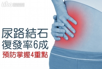 尿路結石復發率6成 預防掌握4重點