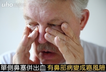 單側鼻塞併出血 有鼻部病變成癌風險