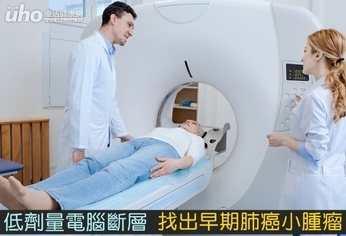 低劑量電腦斷層 找出早期肺癌小腫瘤