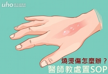 燒燙傷怎麼辦?醫師教緊急處置SOP