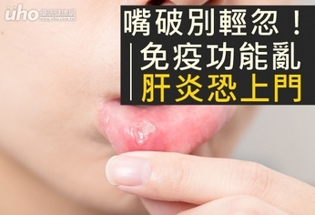嘴破別輕忽!免疫功能亂肝炎恐上門